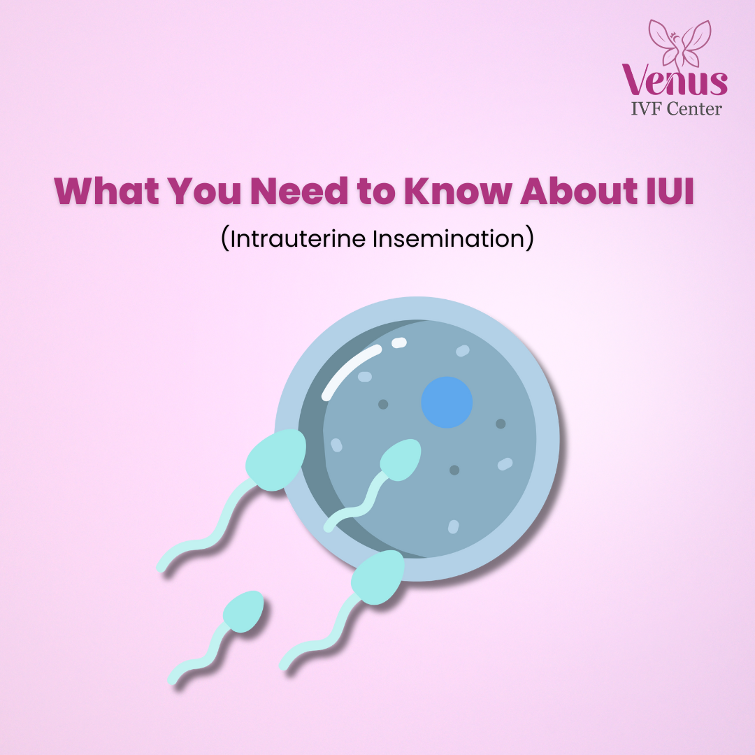 What You Need to Know About IUI (Intrauterine Insemination)